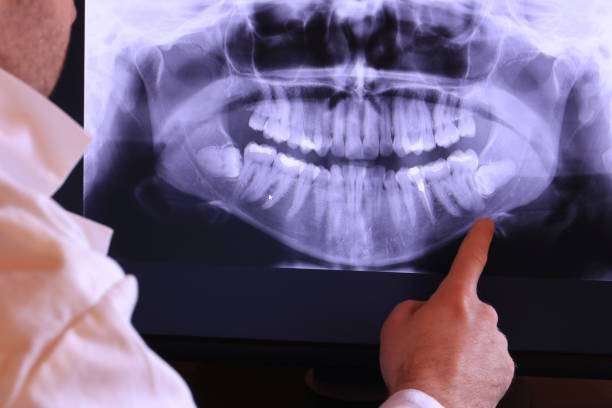 Best Emergency Care for Gum Disease in Bessemer, MI