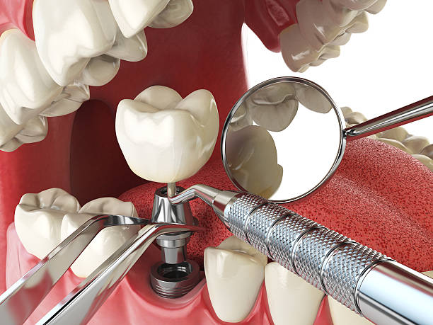Best Emergency Treatment for Jaw Pain or Injury in Bessemer, MI